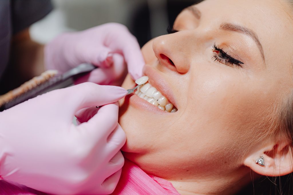 veneers turkey cost