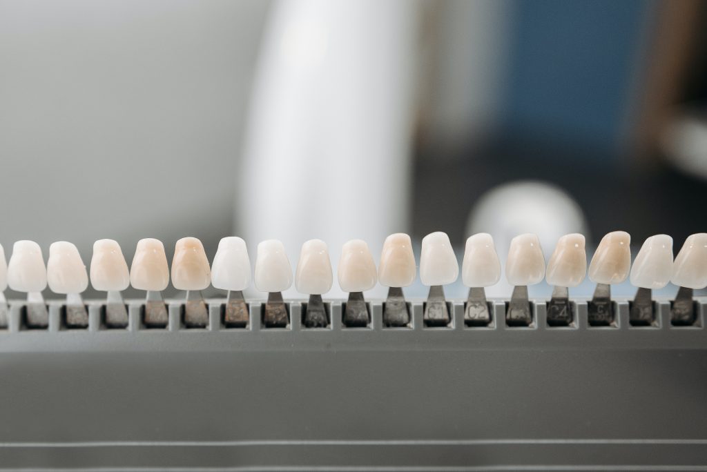 e-max veneers