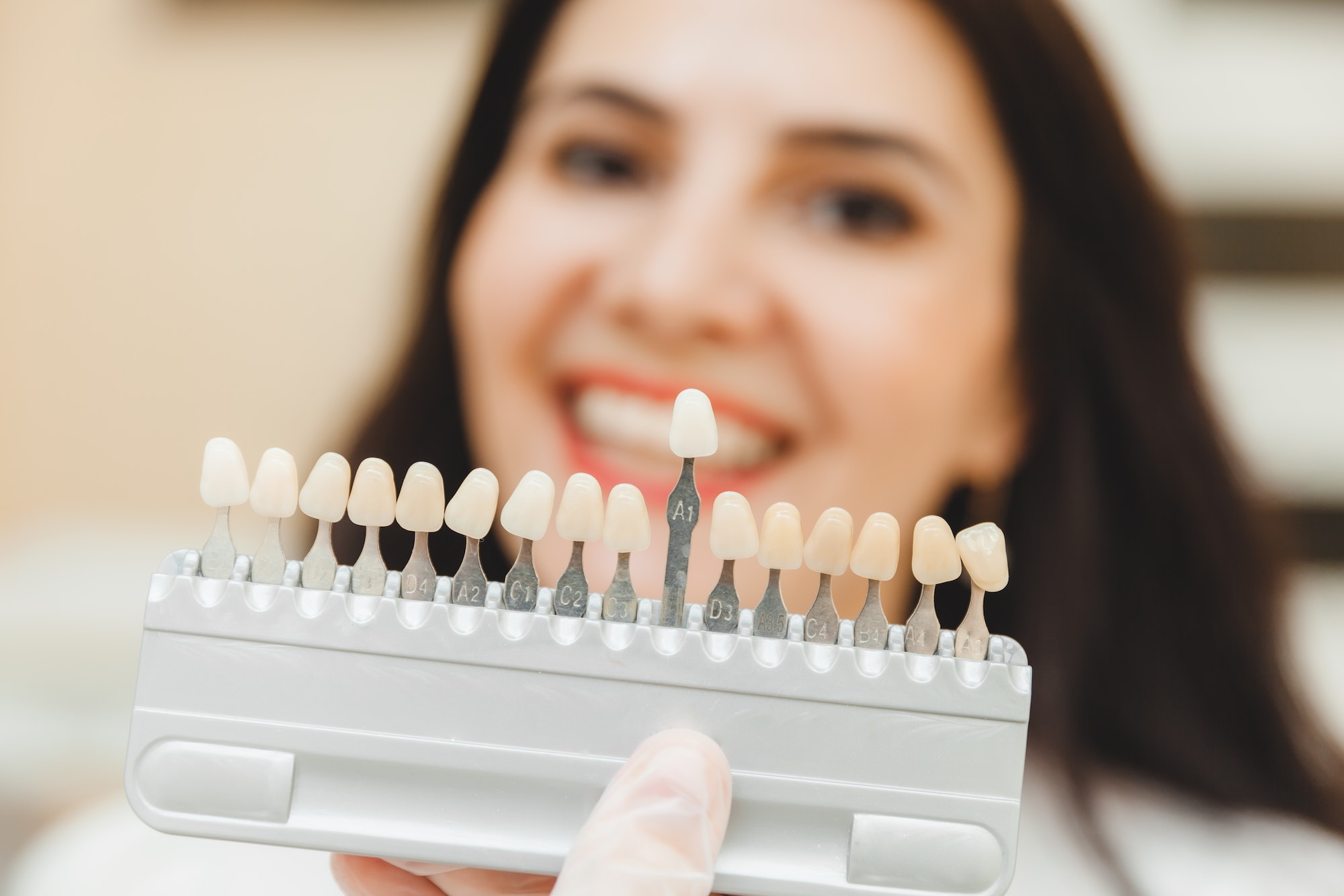 What to Expect During Your Cosmetic Dentistry Consultation in Turkey