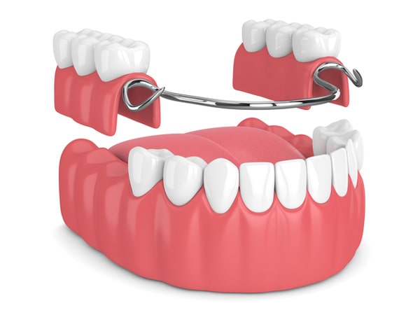 Explore our dental blog for expert insights, tips, and the latest trends in dental care. Stay informed and enhance your oral health knowledge today!