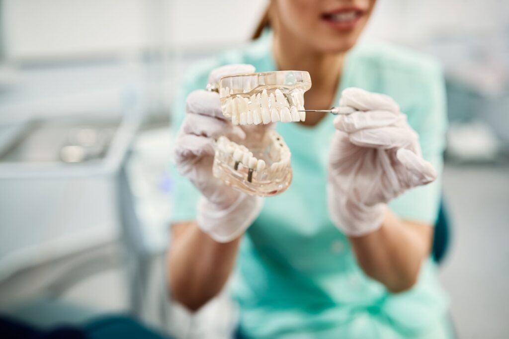Close-up of dentist holding dentures and showing how dental implant looks like.