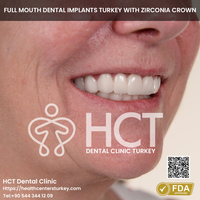 all on 6 dental implant treatment with full mouth dental implants turkey package deals