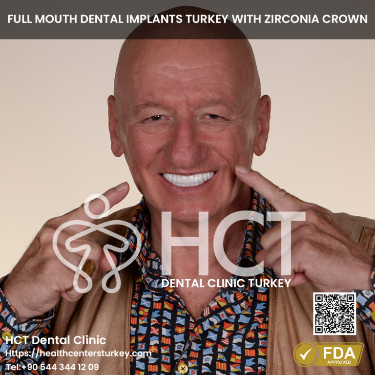 all on 4 dental implants turkey package deals in Antalya
