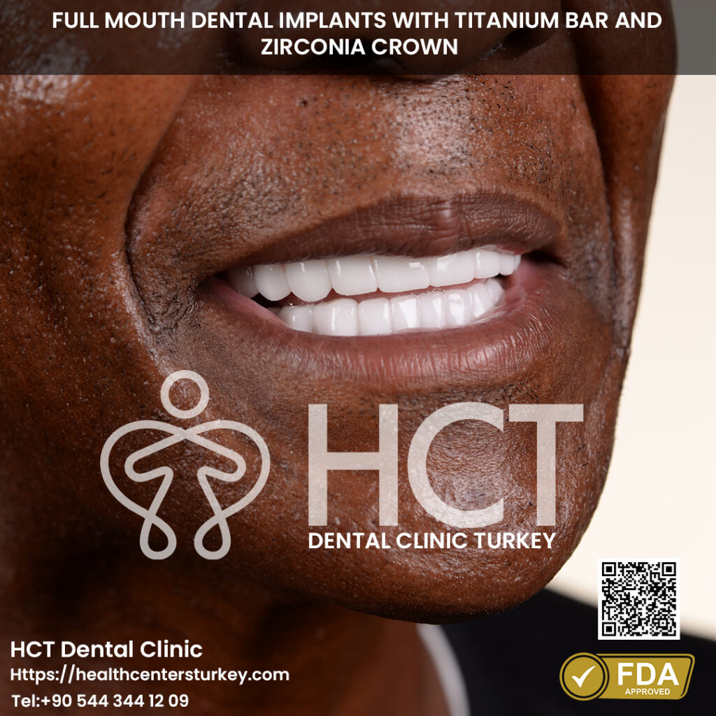 Full Mouth Dental Implants in Turkey 5 all on 6 dental implants package deals treatment in turkey with titanium bar and zirconia crown