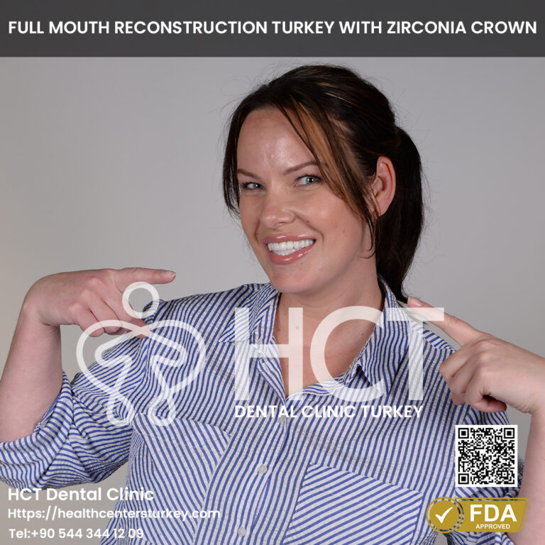 hollywood smile reconstruction with dental implants turkey package deals