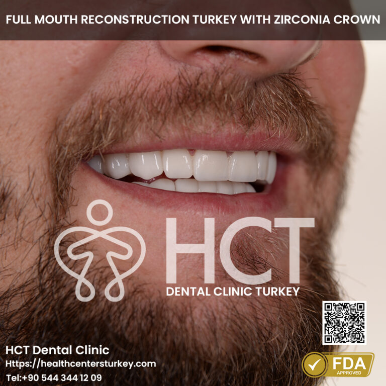 Full mouth reconstruction turkey with dental implants and zirconia crowns