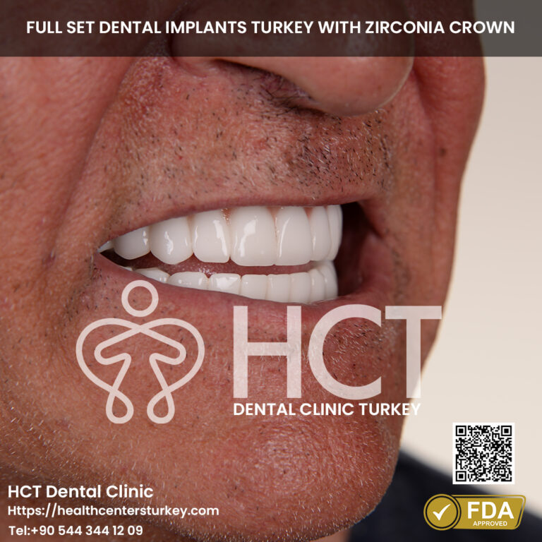 full mouth dental implants turkey package deals final result with all on 6 treatment