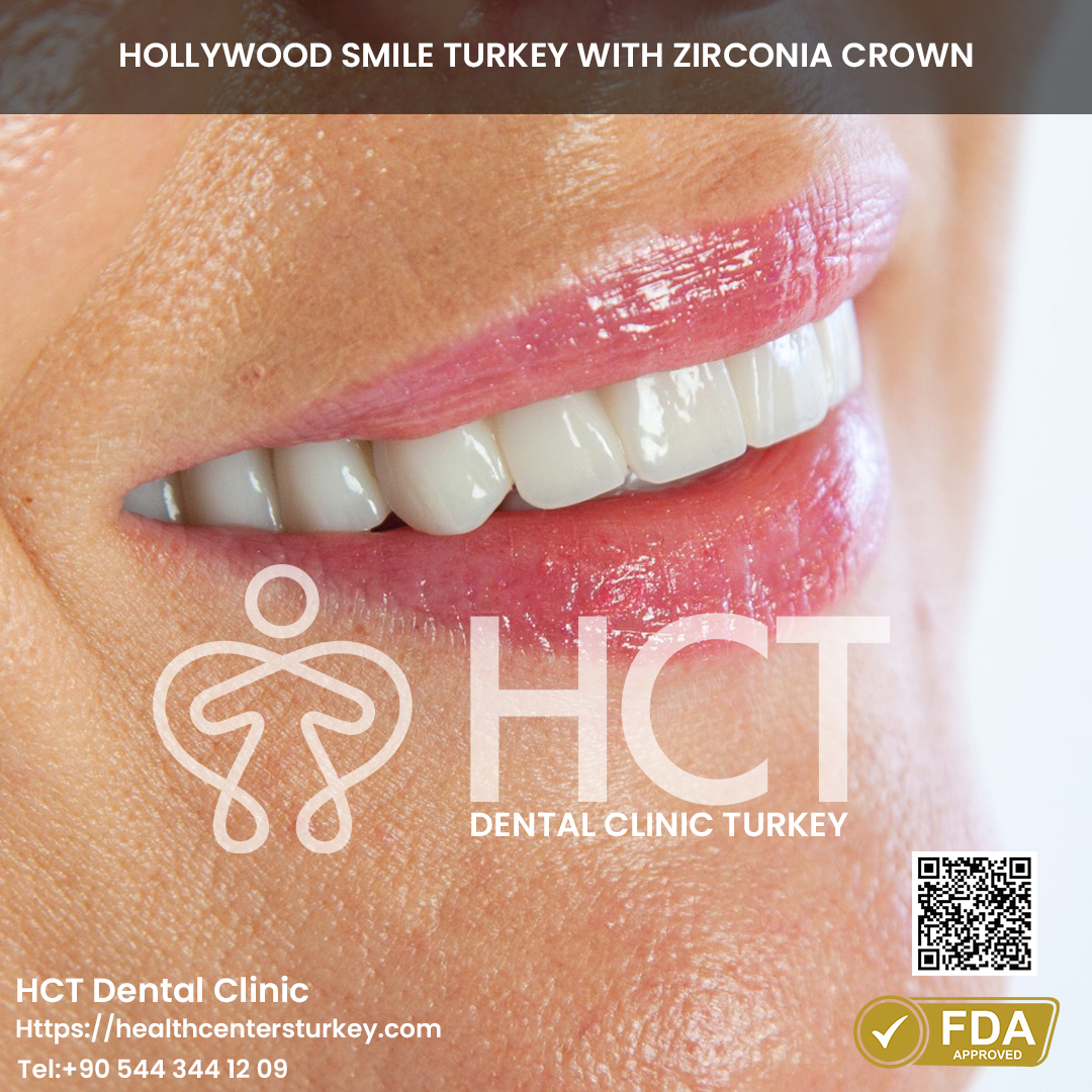 Smile makeover with dental implants turkey package deals final result