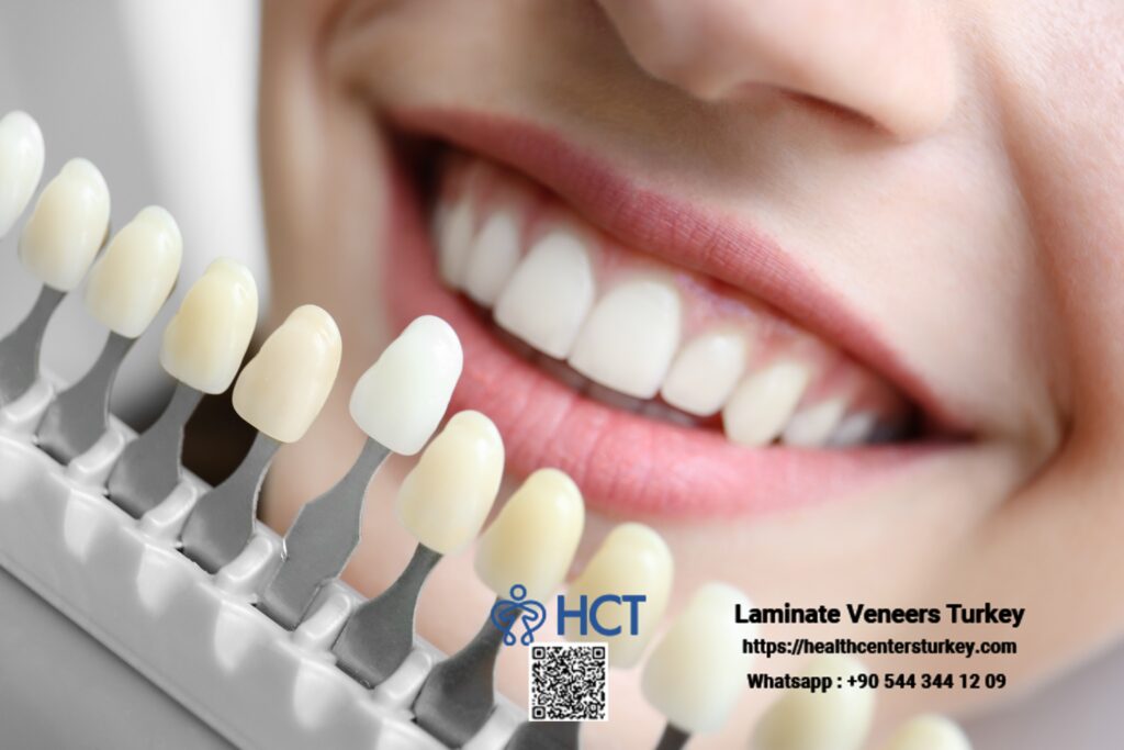 Laminate Veneers Turkey highlights the beauty and functionality of high-quality Laminate Teeth.